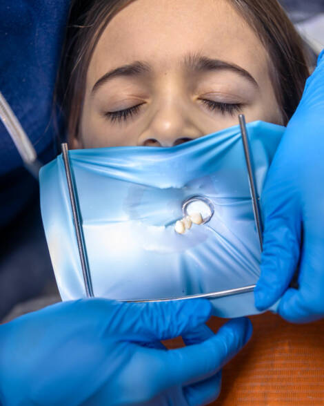 Oral Transmucosal Films